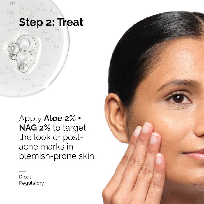 Aloe 2% + NAG 2% Solüsyon Seru - Aha Bha Exfoliant incelemesi ve fiyatı