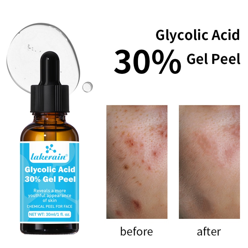 30% Glikolik Asit Peel Jel Pro - Lactic Acid Toner incelemesi ve fiyatı