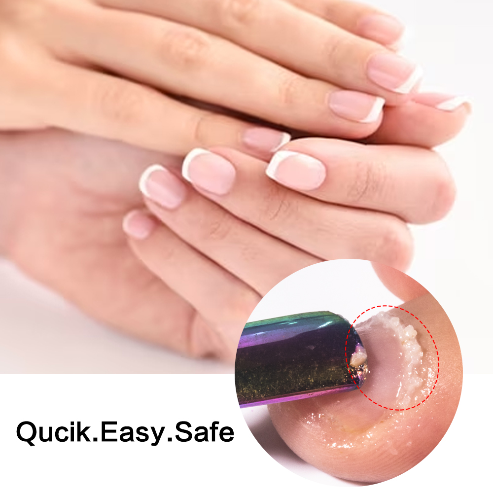 KODIES JEL Tırnak Eti Çıkarıcı - Aha Bha Exfoliant incelemesi ve fiyatı